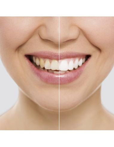 Strisce Sbiancanti Denti Wripes InnovaGoods | Sorriso Bianco Rapido